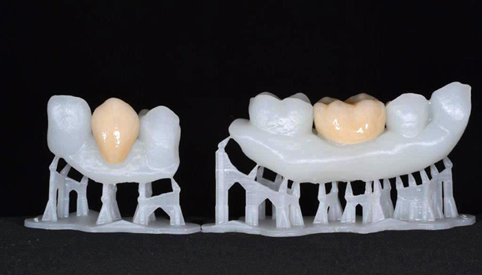 پرینتر سه بعدی در صنعت دندان پزشکی
